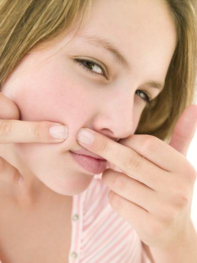 Одна из главных проблем подростковой кожи – это угревая болезнь (акне).